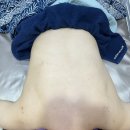 채움교육연구소 | [동탄에스테틱] 채움피부연구소 동탄본점 등드름 관리 솔직 후기