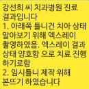 7월25일 강선희씨 단대치과병원 진료 결과 이미지