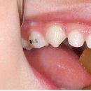 리더스덴탈 이미지