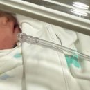 올리브통의원 | [육아] 건국대학병원 유도분만 제왕절개 엔딩 후기