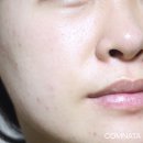 큐어시스 이미지