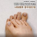 플롯 | 광주네일 발톱교정 네일플롯 광주첨단점 아크릴페디 후기