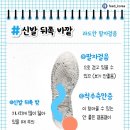 신발닳는 모양 이미지