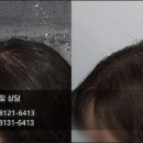 행복한헤어라인
