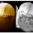 오혜명시온백년치과의원 이미지