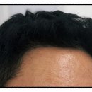 모디헤어플란트의원 이미지