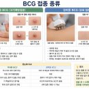 심낭골 네이버블로그