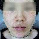 장애인교육 전문강사 자격증과정 | 대전 관저동 기미관리 잘하는 곳 | 뷰마르 대전관저점 플라즈마 후기 | 대전 피부자격증 교육까지