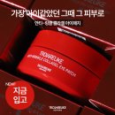 킨아이 이미지
