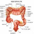 종양구별 양성 악성이란 이미지