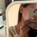 분수대약국 | 닥터 예스키놀 젤 포르테 찐 후기