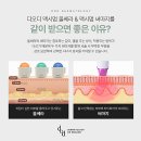 디오피부과의원 | 처짐과 탄력 저하 겹친다면? 청담피부과전문의가 들려주는 울써마지 효과