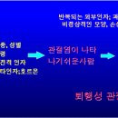 [관절염증상] 퇴행성 관절염 원인 = 관절염증상 이미지