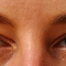 밝은한의원 이미지