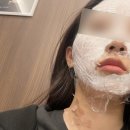 더메이피부과의원 | 메이퓨어 피부과에서 가성비로 편평사마귀 제거한 후기 ! (내돈내산)