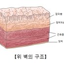 만성 위염(Chronic gastritis) 이미지