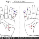 서암뜸 - 설사 , 수면부족 , 비만 무릅관절염 이미지