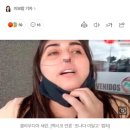 "PCR검사 후, 코 연골 부러졌다"…콧구멍 1개 된 여성의 눈물 이미지