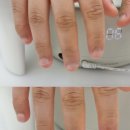 희망 아크릴 | 평택 물어뜯는 손톱 교정 최다 시술! 초롬뷰티 아크릴 네일 후기