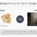 삼성올바른치과의원 네이버블로그