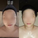 수연에스테틱 - 강남구 | 김해 시그니처 피부 리프팅관리 에스테틱 수연 재방문 후기