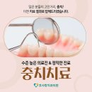 횡성세탁전문점 | 경상남도 거창군 임플란트 전문 치과 잘하는 곳 BEST 추천 6곳