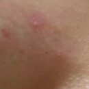 고운세상김양제장봉석피부과의원 | 고운세상 김양제장봉석피부과의원/부산 부산진구 부전동/정보클릭