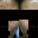 연세지움 Daum카페