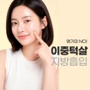 멍메이드 | 턱살지방흡입 후기 진짜 멍 안생기네요