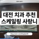 플랜트치과의원 | 대전 치과 추천, 스케일링, 사랑니 발치, 레진 플랜트치과 후기 내돈내산