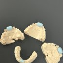 하이치과기공소 이미지