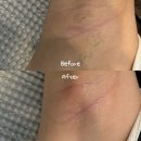 수원 스타필드 화서역 근처 겨드랑이 왁싱 잘하는 보넬뷰티샵