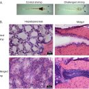 흰다리새우 translucent post-larvae disease (TPD)의 원인 Vibrio parahemolyticus 이미지