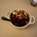 (주)굿팜 | 허벅지 지방 흡입 후 지난 3개월 회고 (라인 변화, 식습관 개선, 운동, 흉터 등)