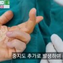 케이스대학