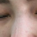 메이드미성형외과