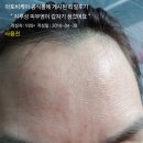 프리미엄 세럼 아토비케이 솔직 후기 :)