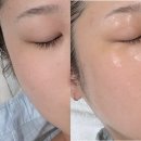 메디뷰제이 | 울산 남구 달동 피부샵 메디뷰제이 LDM 관리 맛집 물광피부 내돈내산 솔직 후기
