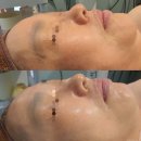 솔깃뷰티 | 일산피부관리: 원하는 아름다움이 이루어지는 공간, 가원뷰티 방문 후기