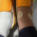 현송한의원 | [용봉동 도란도란한의원] 내돈내산 /까불다가 발목 삐끗- / 약침 효과 만퍼센트 만족