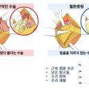 왜 고관절 무릎 인공관절수술은 웰튼병원일까요? - 웰튼병원소개 (2) 이미지