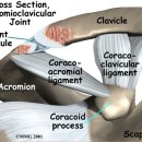 봉우리빗장관절(견쇄관절.ronic AC joint dislocation preoperative shoulder examination) 이미지