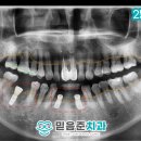 은천동-42 네이버블로그