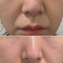 GS25원주기업도시점 | 원주기업도시 피부관리 제이스킨 피부개선 여드름압출 데콜테 수기관리 안내