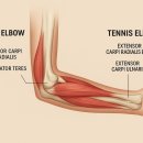 신근열 | 골프엘보·테니스엘보 단 3회 완화! 실전테크닉 공개 세미나 원데이 회복케어, 직접 배워보세요!