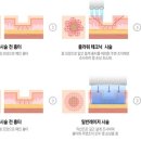 플라워 짐 이미지