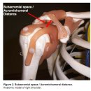 shoulder biomechanics by 김송준 이미지