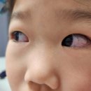 밝은아이안과의원 이미지