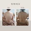 미쁨산후케어 네이버블로그