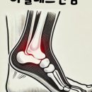 망원경희한의원 네이버블로그